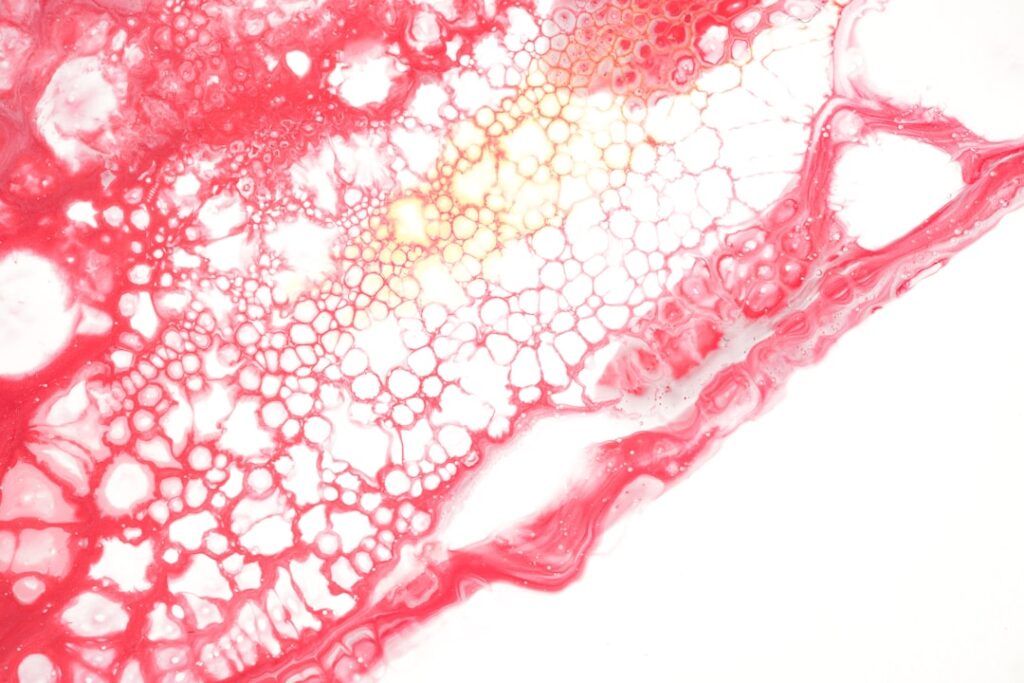 O Que Comer Com Urticária