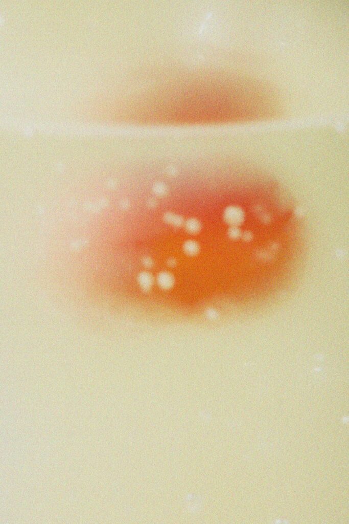 Pratos Anticoceira Imediata