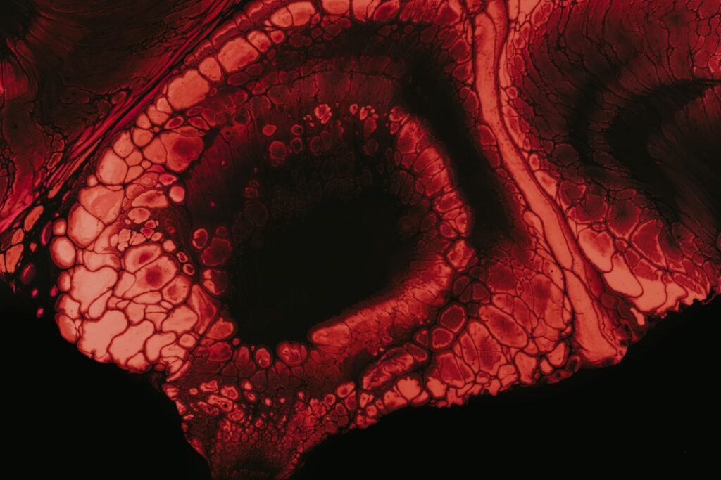 Urticária Col. Dieta Certa